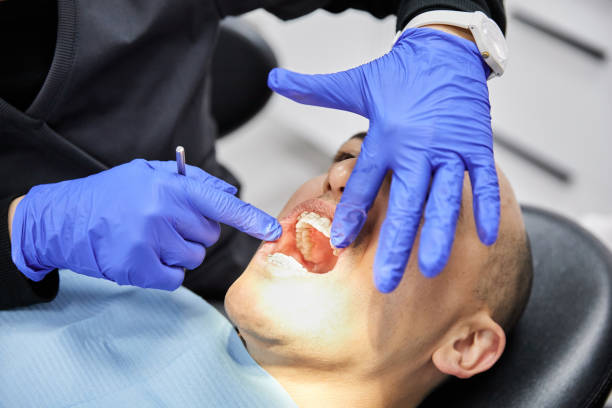 Best Emergency Dental Extractions in Lawton, IA
